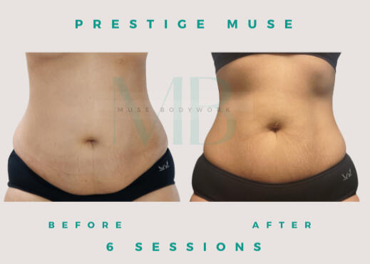 Body Sculpting Body Sculpting